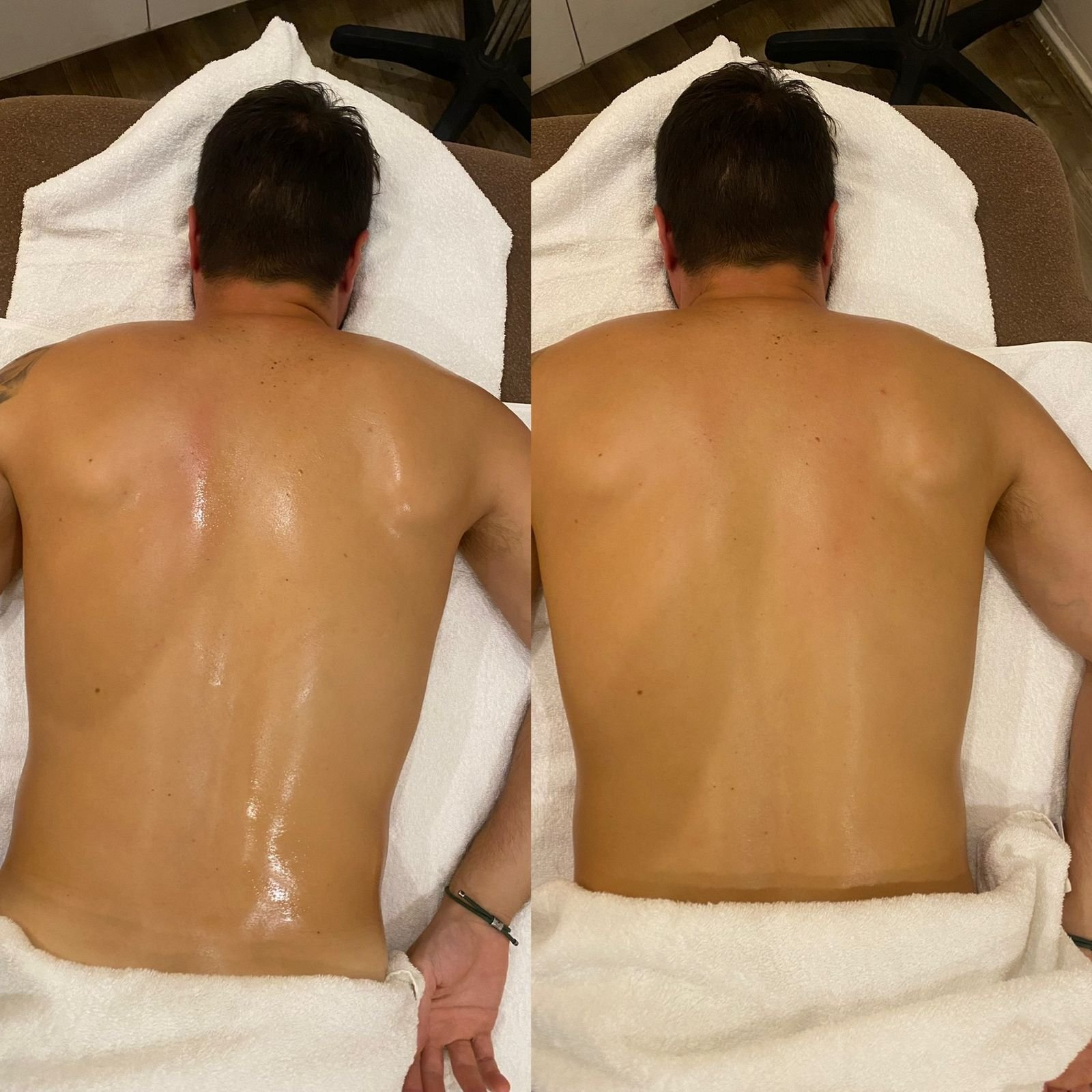 Resultado antes e depois